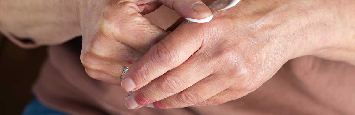 Best Eczema Creams for Eczema & TSW 2024