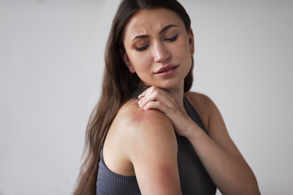 eczema tcm treatment woman suffering from rash